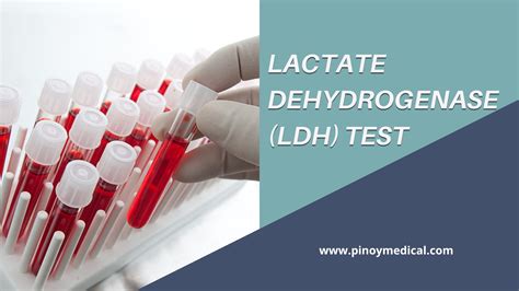 Afbeeldingsresultaten voor LDH Liver Test