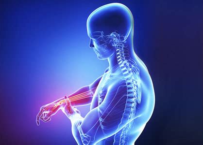 Multifocal Motor Neuropathy Localization に対する画像結果