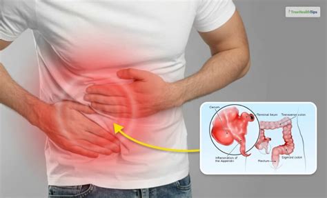 Bildergebnis für Sore Belly Button