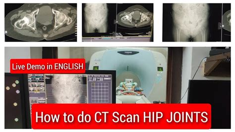 Image result for Scan Protocol