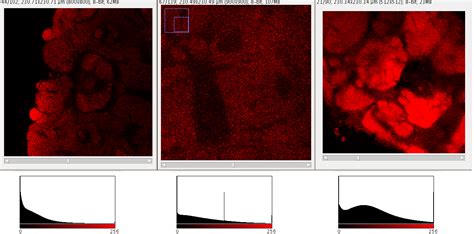 Quantile Normalization に対する画像結果