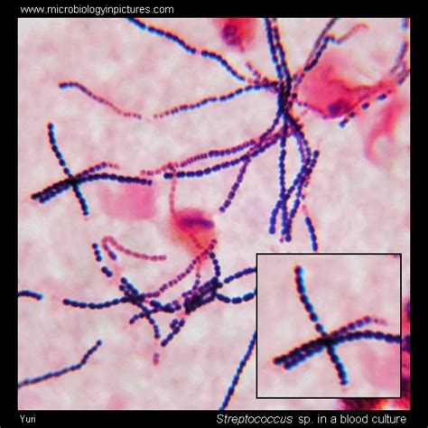 Image result for Strep Gram-positive