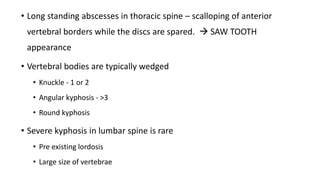 Afbeeldingsresultaten voor Angular Kyphosis TB Spine