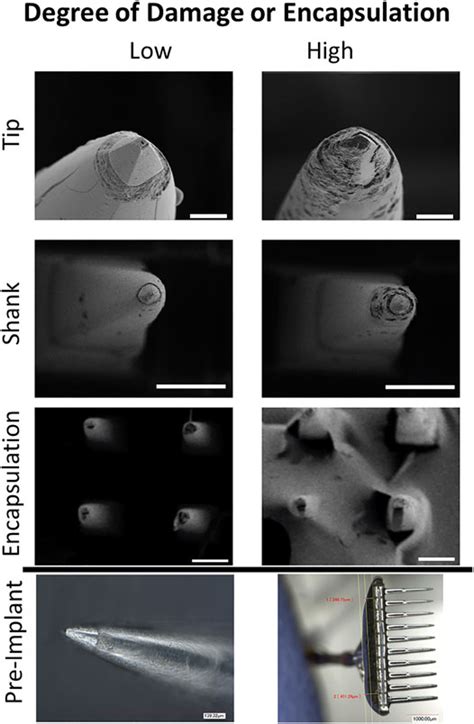 Image result for Utal Electrode Array