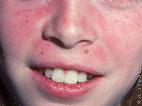 Toradh íomhá ar How Does a Flowchart Look Like