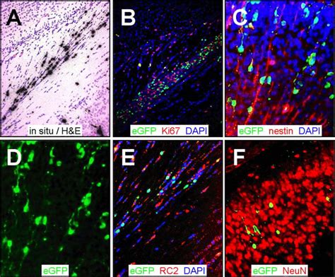 Image result for Cell Control Array Virus