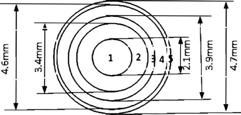 Image result for Refractive Multifocal IOL