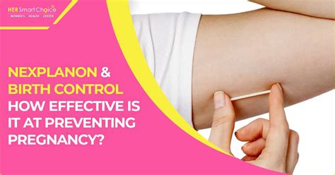 Toradh íomhá ar Nexplanon Animated Image