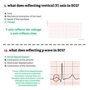 Afbeeldingsresultaten voor EKG Practice Test Questions