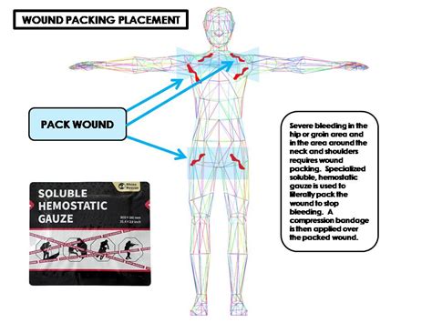 Image result for Packing a Wound