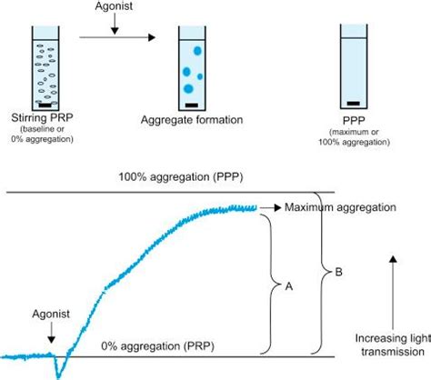 Platelet Aggregation Study Graph に対する画像結果