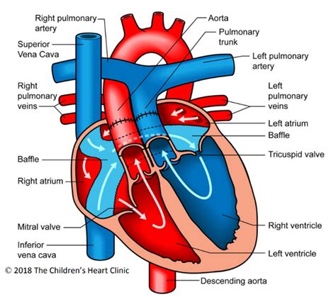 Afbeeldingsresultaten voor Corrected Transposition