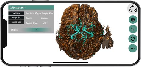 Microscopic Camera App に対する画像結果