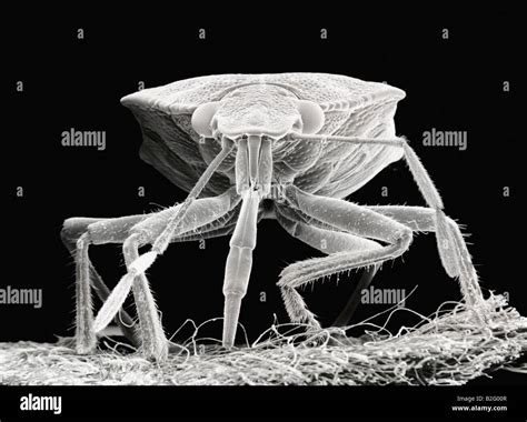 Image result for Insects Under Electron Microscope