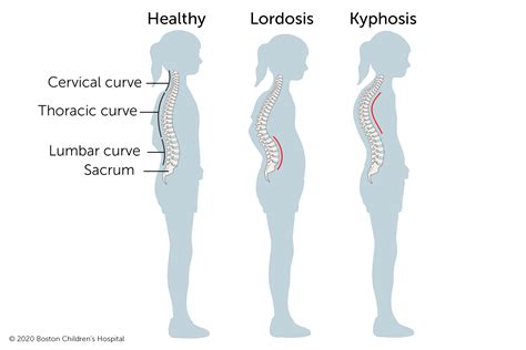 Image result for Normal Back Curve