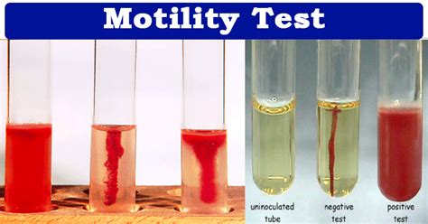 Motility Test.youtube に対する画像結果