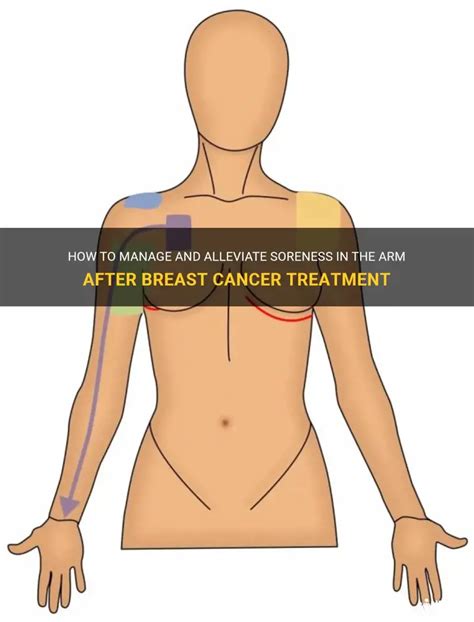 Image result for Arm Cancer