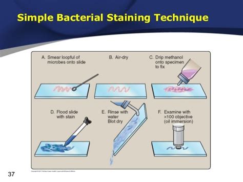 Image result for Simple Staining Technique