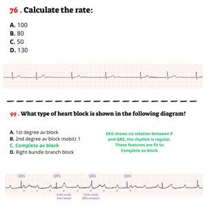Afbeeldingsresultaten voor EKG Practice Test Questions