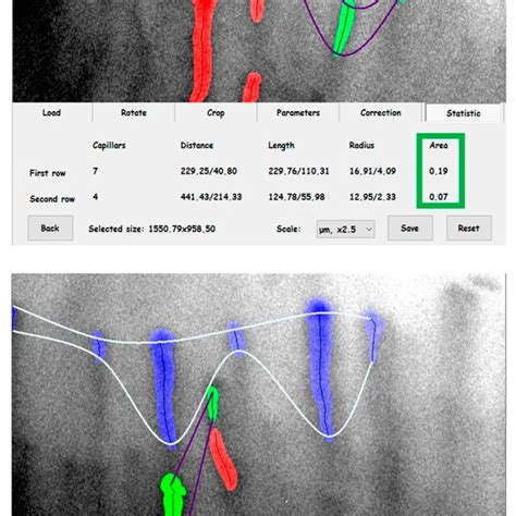 Toradh íomhá ar Per Base Coverage Distribution