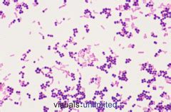 Image result for Glutamicibacter Gram
