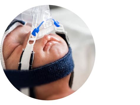 Image result for Newborn CPAP