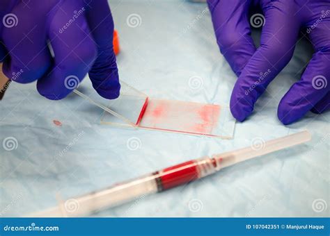 Blood Slide Diagnostic に対する画像結果