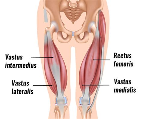 Image result for Strained Thigh Muscle