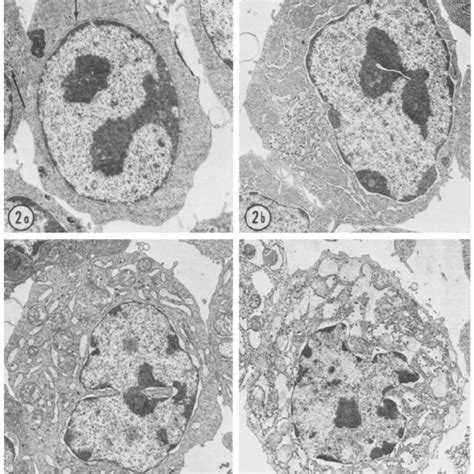 Toradh íomhá ar Maturation Cycle
