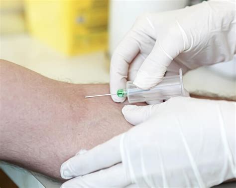 Image result for In Hospital Blood Lab Test