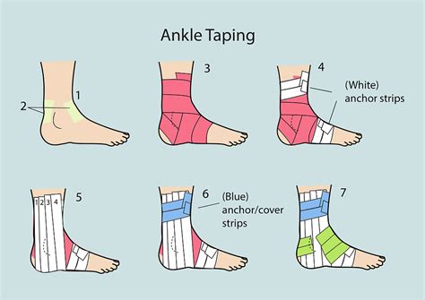 Toradh íomhá ar How to Wrap Ankle Sprain