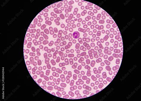 Normal Red Blood Cells Under Microscope-साठीचा प्रतिमा निकाल