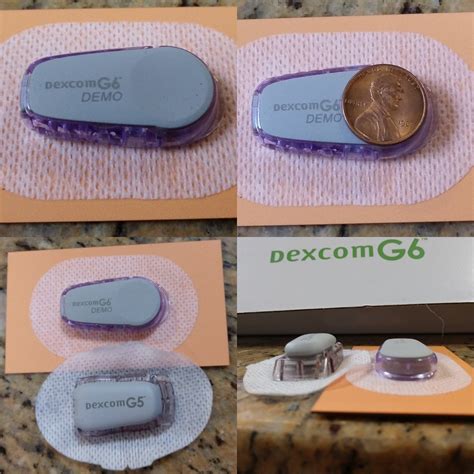 Image result for Dexcom Transmitter Receiver G6