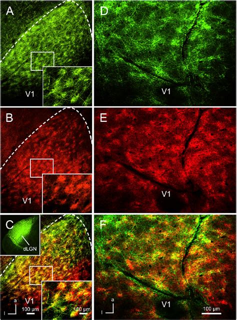 Image result for Mouse Visual Cortex Organization V1