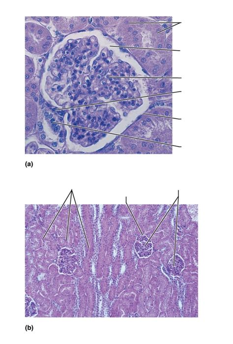 Toradh íomhá ar Microscopic Structural Pattern Diagram of Kidney