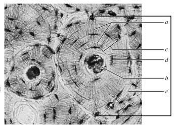 Compact Bone Under Microscope Label に対する画像結果