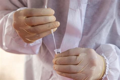 Swab Test Sample に対する画像結果