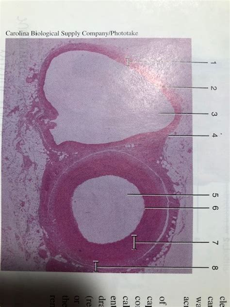Transverse Section of Vein and Artery に対する画像結果