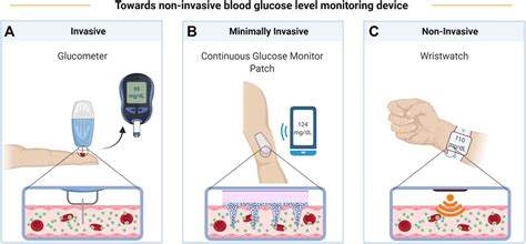 Toradh íomhá ar Continuous Monitoring System