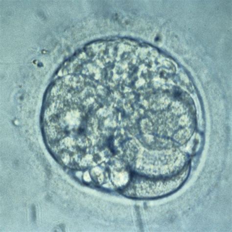 Image result for Human Embryo Electron Microscope