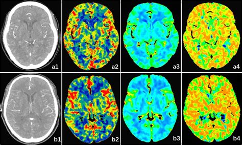 Image result for Scan Protocol