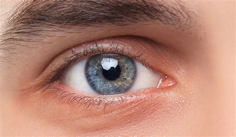 Toradh íomhá ar Blefaritis Demodex