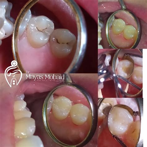 Toradh íomhá ar Icon Mayas