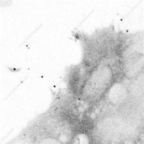 Image result for Focal Adhesion Image Electron Microscope