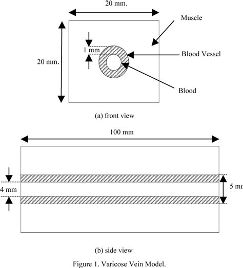 Image result for Vein Diameter Finding Methods Using MATLAB