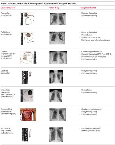 Afbeeldingsresultaten voor Cardiac Rhythm Management Devices