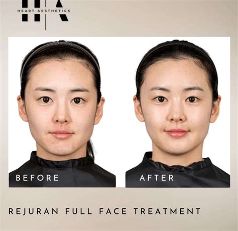 Tax File Declaration Form に対する画像結果