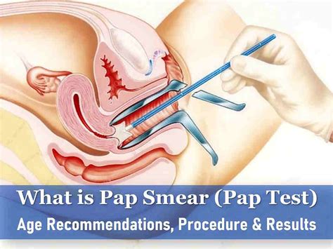 Image result for Pap Smear Performed