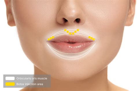 Image result for Botox Lip Flip with Cupid's Bow