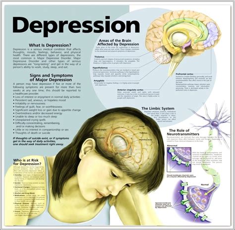Depression Graph に対する画像結果
